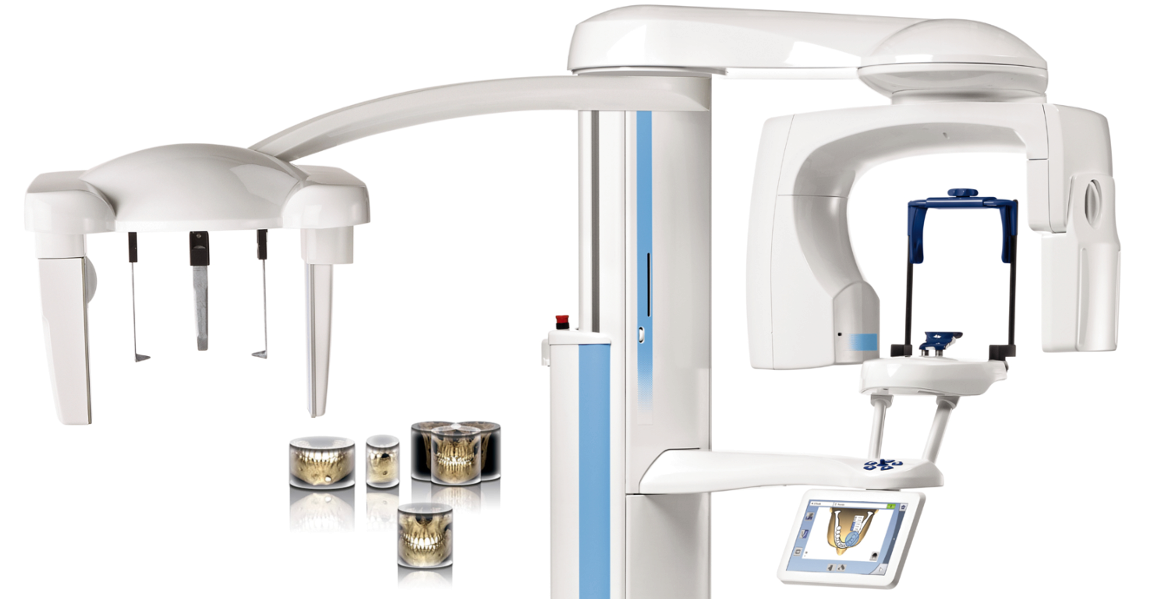 3D скенер