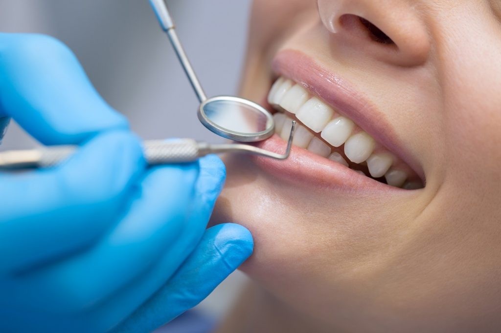 dentalna-profilaktika-city-dent